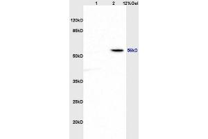 Lane 1: rat brain lysates Lane 2: rat heart lysates probed with Anti ABI1 Polyclonal Antibody, Unconjugated (ABIN675953) at 1:200 in 4 °C. (ABI1 antibody  (AA 101-200))