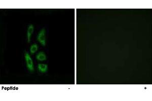 Immunofluorescence analysis of A-549 cells, using ACOT12 polyclonal antibody .