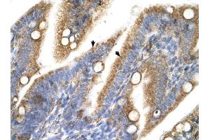 TRPM5 antibody was used for immunohistochemistry at a concentration of 4-8 ug/ml to stain Epithelial cells of intestinal villus (arrows) in Human Intestine. (TRPM5 antibody  (N-Term))