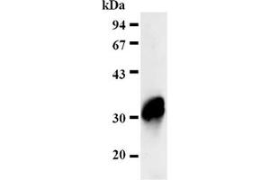 Western Blotting (WB) image for anti-Four and A Half LIM Domains 2 (FHL2) antibody (ABIN487469) (FHL2 antibody)