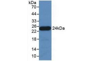 Detection of Recombinant APOE, Porcine using Polyclonal Antibody to Apolipoprotein E (APOE) (APOE antibody  (AA 16-175))