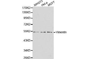 Western blot analysis of extracts of various cell lines, using VIM antibody. (Vimentin antibody)