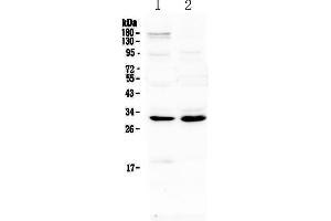 Western blot analysis of IL1 beta using anti-IL1 beta antibody . (IL-1 beta antibody)