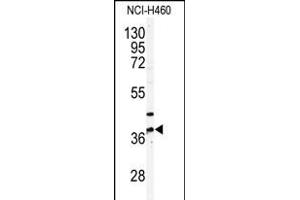 Western blot analysis of anti-NK3 Antibody (N-term) (ABIN391239 and ABIN2841307) in NCI- cell line lysates (35 μg/lane). (PANK3 antibody  (N-Term))