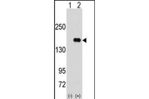 Western blot analysis of PUM2 (arrow) using rabbit polyclonal PUM2 Antibody (N-term) (ABIN391821 and ABIN2841667). (PUM2 antibody  (N-Term))