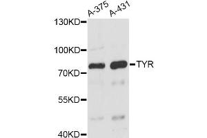 Western blot analysis of extracts of various cell lines, using TYR antibody. (TYR antibody)