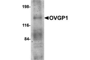 Western Blotting (WB) image for anti-Oviductal Glycoprotein 1 (OVGP1) (N-Term) antibody (ABIN1031498) (OVGP1 antibody  (N-Term))