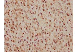 Immunohistochemistry (IHC) image for anti-Cell Division Cycle 25 Homolog C (S. Pombe) (CDC25C) antibody (ABIN7127412)