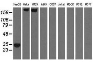 Image no. 1 for anti-Sulfotransferase Family, Cytosolic, 2A, Dehydroepiandrosterone (DHEA)-Preferring, Member 1 (SULT2A1) antibody (ABIN1501236) (SULT2A1 antibody)