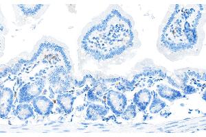 Immunohistochemistry (IHC) image for anti-CD28 (CD28) (AA 170-220) antibody (ABIN7455122) (Recombinant CD28 antibody  (AA 170-220))