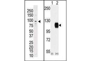Image no. 1 for anti-TYRO3 Protein Tyrosine Kinase (TYRO3) (C-Term) antibody (ABIN359940) (TYRO3 antibody  (C-Term))
