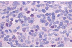 Anti-FPR1 antibody  ABIN1048601 IHC staining of human spleen.