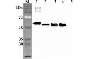 Western blot analysis using anti-Calreticulin (human), pAb  at 1:4'000 dilution. (Calreticulin antibody)