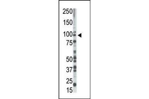 Image no. 1 for anti-Mitogen-Activated Protein Kinase Kinase Kinase Kinase 1 (MAP4K1) (C-Term) antibody (ABIN360390) (MAP4K1 antibody  (C-Term))