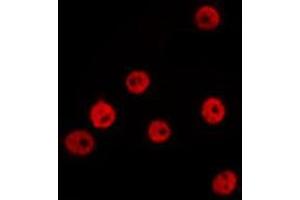 ABIN6277656 staining Hela by IF/ICC. (ZEB1 antibody  (Internal Region))