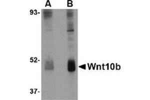 Western blot analysis of Wnt10b in human skeletal muscle tissue lysate with this product at (A) 2 and (B) 4 μg/ml. (WNT10B antibody  (Center))