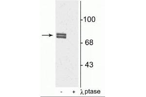 Western blot of rat cortical lysate showing specific immunolabeling of the ~80 kDa doublet of 5-LO phosphorylated at Ser523 in the first lane (-). (ALOX5 antibody  (pSer523))