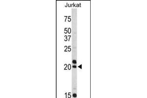 Western blot analysis of VIP antibody (C-term) (ABIN390468 and ABIN2840836) in Jurkat cell line lysates (35 μg/lane). (Vip antibody  (C-Term))