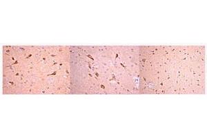 Immunohistochemistry: 1:50-1:300 working dilutions of anti-Prion Protein, clone 2G11 localizes prion protein in rat brain paraffin embedded tissue (High & Low Magnification). (PRNP antibody)