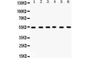 Western Blotting (WB) image for anti-Dihydrolipoamide Dehydrogenase (DLD) (AA 300-509) antibody (ABIN3043561)