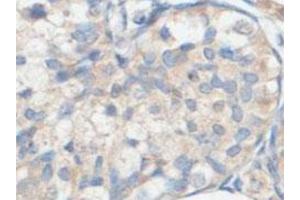 Immunohistochemical analysis of paraffin-embedded human fetal testis showing cytoplasmic staining with ACOT9 polyclonal antibody  at a 1 : 100 dilution.