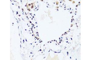 Immunohistochemistry of paraffin-embedded Human lung using BRIX1 Polyclonal Antibody at dilution of 1:100 (40x lens).