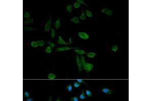 Immunofluorescence analysis of HeLa cells using SIRT7 Polyclonal Antibody (SIRT7 antibody)