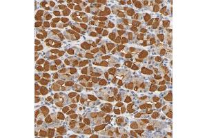 Immunohistochemical staining (Formalin-fixed paraffin-embedded sections) of human stomach shows strong cytoplasmic positivity in glandular cells. (UCKL1 antibody  (AA 86-203))