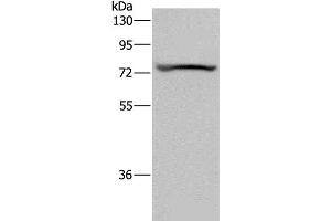 Western Blot analysis of Mouse heart tissue using KCNQ1 Polyclonal Antibody at dilution of 1:200 (KCNQ1 antibody)