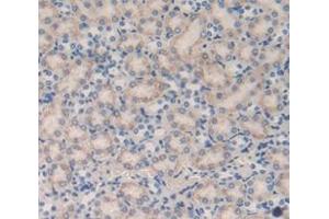 IHC-P analysis of Mouse Tissue, with DAB staining. (CUBN antibody  (AA 3511-3623))
