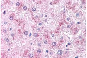Human Liver (formalin-fixed, paraffin-embedded) stained with CRADD antibody ABIN213922 at 5 ug/ml followed by biotinylated goat anti-rabbit IgG secondary antibody ABIN481713, alkaline phosphatase-streptavidin and chromogen. (CRADD antibody  (AA 99-117))