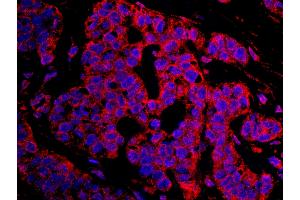 Immunofluorescence (IF) image for anti-Cancer Susceptibility Candidate 3 (CASC3) (AA 653-703) antibody (ABIN7448936) (CASC3 antibody  (AA 653-703))