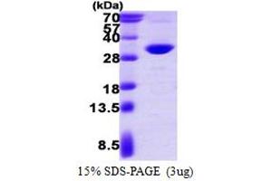 SDS-PAGE (SDS) image for Proteasome (Prosome, Macropain) Activator Subunit 2 (PA28 Beta) (PSME2) (AA 1-239) protein (His tag) (ABIN7529187) (PSME2 Protein (AA 1-239) (His tag))