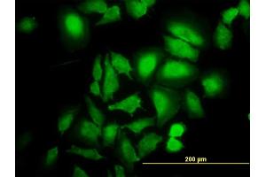 Immunofluorescence of monoclonal antibody to ABL2 on HeLa cell. (ABL2 antibody  (AA 743-842))