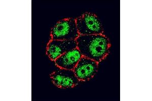 Confocal immunofluorescent analysis of NFKBIA Antibody ( S32/36 ) (ABIN652417 and ABIN2842077) with ZR-75-1 cell followed by Alexa Fluor 488-conjugated goat anti-rabbit lgG (green). (NFKBIA antibody  (AA 12-41))