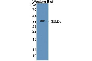 Western blot analysis of the recombinant protein. (KEL antibody  (AA 439-713))