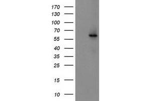 HEK293T cells were transfected with the pCMV6-ENTRY control (Left lane) or pCMV6-ENTRY CYP2J2 (Right lane) cDNA for 48 hrs and lysed. (CYP2J2 antibody)