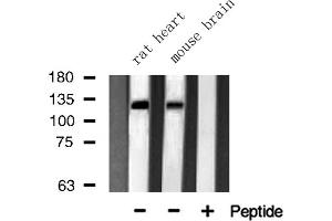 Western blot analysis of JMY using Jurkat whole cell lysates (JMY antibody  (C-Term))