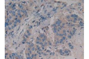 Immunohistochemistry (IHC) image for anti-Wingless-Type MMTV Integration Site Family, Member 3A (WNT3A) (AA 1-290) antibody (ABIN7430189)