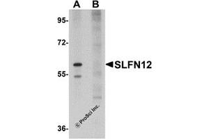 Western Blotting (WB) image for anti-Schlafen Family Member 12 (SLFN12) (C-Term) antibody (ABIN1030678) (SLFN12 antibody  (C-Term))