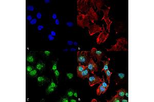 Immunocytochemistry/Immunofluorescence analysis using Rabbit Anti-Adenosine receptor A1 Polyclonal Antibody .