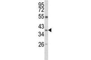 Western blot analysis of ARG1 antibody and MDA-MB231 lysate