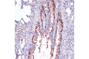 Immunohistochemistry of paraffin-embedded rat lung using RPL22 antibody (ABIN6128682, ABIN6147119, ABIN6147120 and ABIN6224925) at dilution of 1:100 (40x lens). (RPL22 antibody  (AA 1-122))