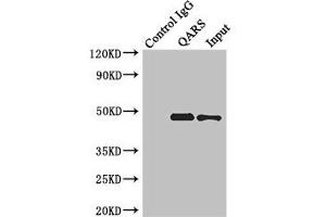 Immunoprecipitating ENTPD5 in Hela whole cell lysate Lane 1: Rabbit control IgG instead of (1 μg) instead of ABIN7151376 in Hela whole cell lysate. (ENTPD5 antibody  (AA 149-428))