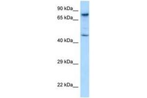 Image no. 1 for anti-SKI-Like Oncogene (SKIL) (AA 542-591) antibody (ABIN6748077)
