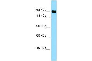 WB Suggested Anti-PLXNB3 Antibody Titration: 1. (Plexin B3 antibody  (C-Term))