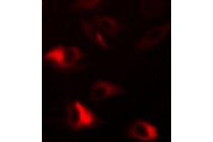 Immunofluorescent analysis of Peroxiredoxin 2 staining in HepG2 cells. (Peroxiredoxin 2 antibody)
