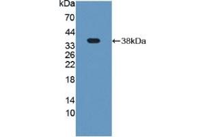 Western blot analysis of recombinant Rat Plg. (PLG antibody  (AA 191-433))