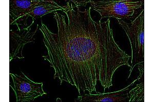 Immunofluorescence (IF) image for anti-FYN Oncogene Related To SRC, FGR, YES (FYN) (AA 7-176) antibody (ABIN94311)