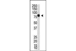 Image no. 1 for anti-Protein Inhibitor of Activated STAT, 4 (PIAS4) (C-Term) antibody (ABIN356771) (PIAS4 antibody  (C-Term))